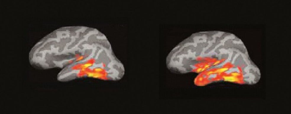 (A la izquierda) 3. Se produce una explosión de actividad en múltiples áreas de las regiones temporal y frontal del hemisferio izquierdo. El cerebro recopila todo lo que sabe de esa palabra. fonética, función sintáctica, significado… (A la derecha) 4. El ‘incendio’ se extiende, creando circuitos neuronales que conectan los procesos del lenguaje, visuales, espaciales… Comprendemos, sacamos conclusiones y surgen los recuerdos y los pensamientos propios.