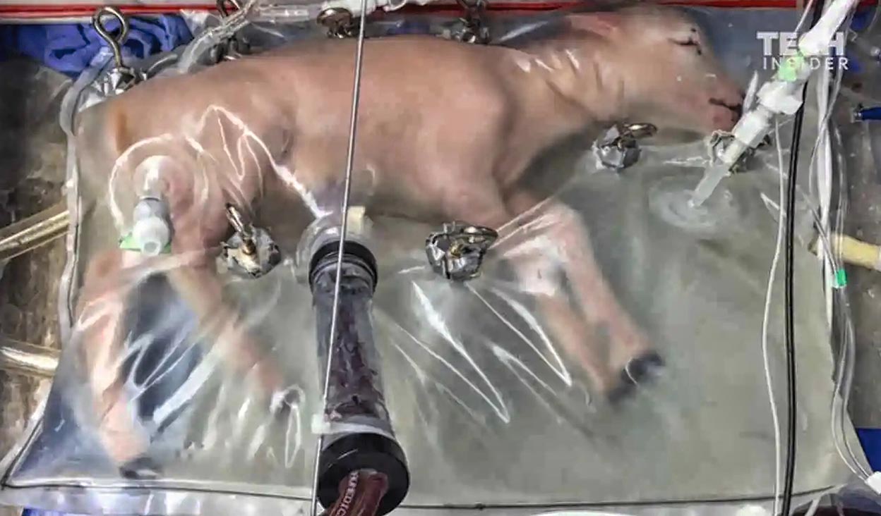 Los hospitales barceloneses Clínic y Sant Joan de Déu están probando una placenta artificial para bebés muy prematuros. Es una bolsa que imita al vientre materno. El bebé recibe oxígeno y nutrientes a través del cordón umbilical. Ya se han logrado supervivencias en ovejas.