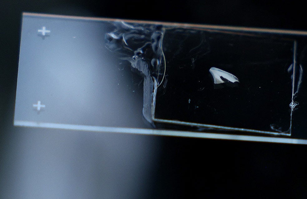 Sección longitudinal de un diente de leche analizado al microscopio. La madre del niño estaba embarazada cuando tuvo lugar el atentado de la maratón en Boston. Los investigadores intentan localizar señales de estrés.