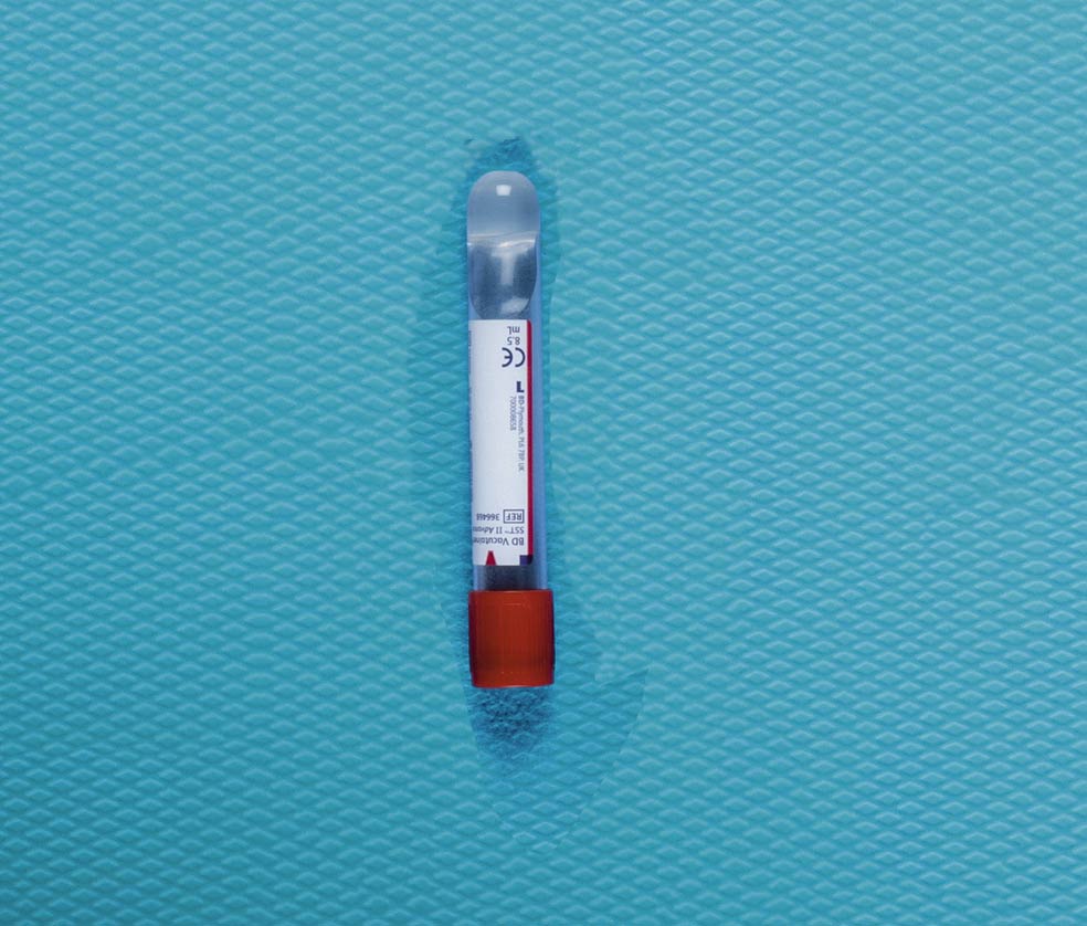 Imagen - ¿ENFERMEDAD DE TRANSMISIÓN SEXUAL?Para constatar que no le han transmitido alguna, se hace un análisis de sangre, también para confirmar que no había embarazo previo.