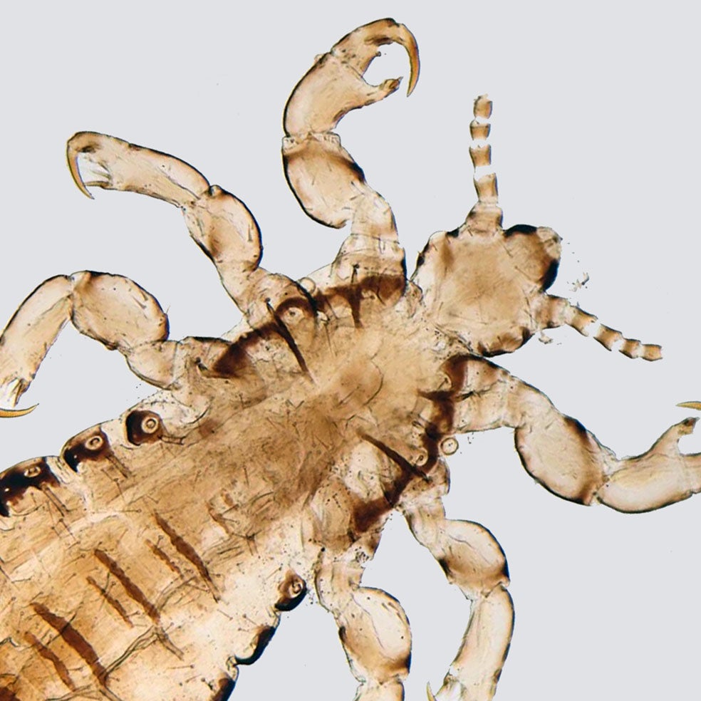 Imagen - 1. Cabello: Territorio del piojo