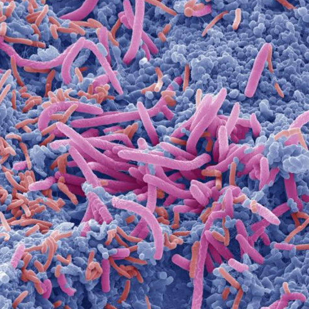 Imagen - 3. Boca: Sin higiene, hay placa