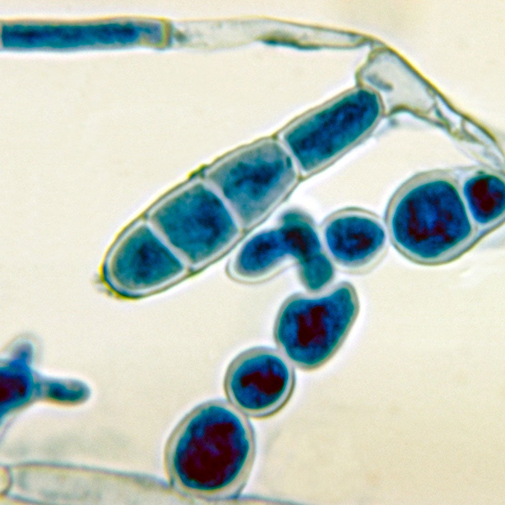 Imagen - 7. Tiña podal: Dando pie a la infección
