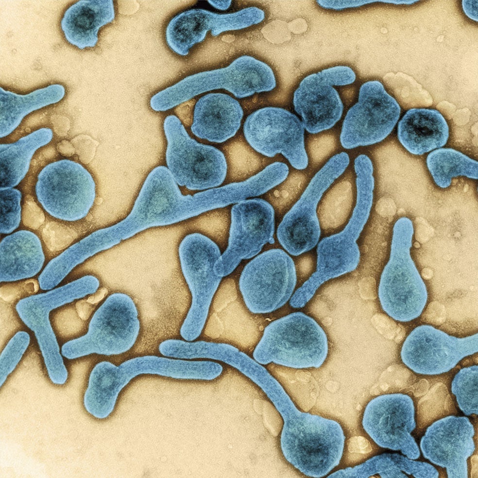 Aunque el de Marburgo y el ébola son virus distintos, ambos pertenecen a la familia de los Filoviridae, llamados así por la forma de sus viriones (partículas virales), parecidos a largos filamentos. Ambos patógenos destruyen el sistema inmune y causan enfermedades con similares características clínicas y altas tasas de letalidad.