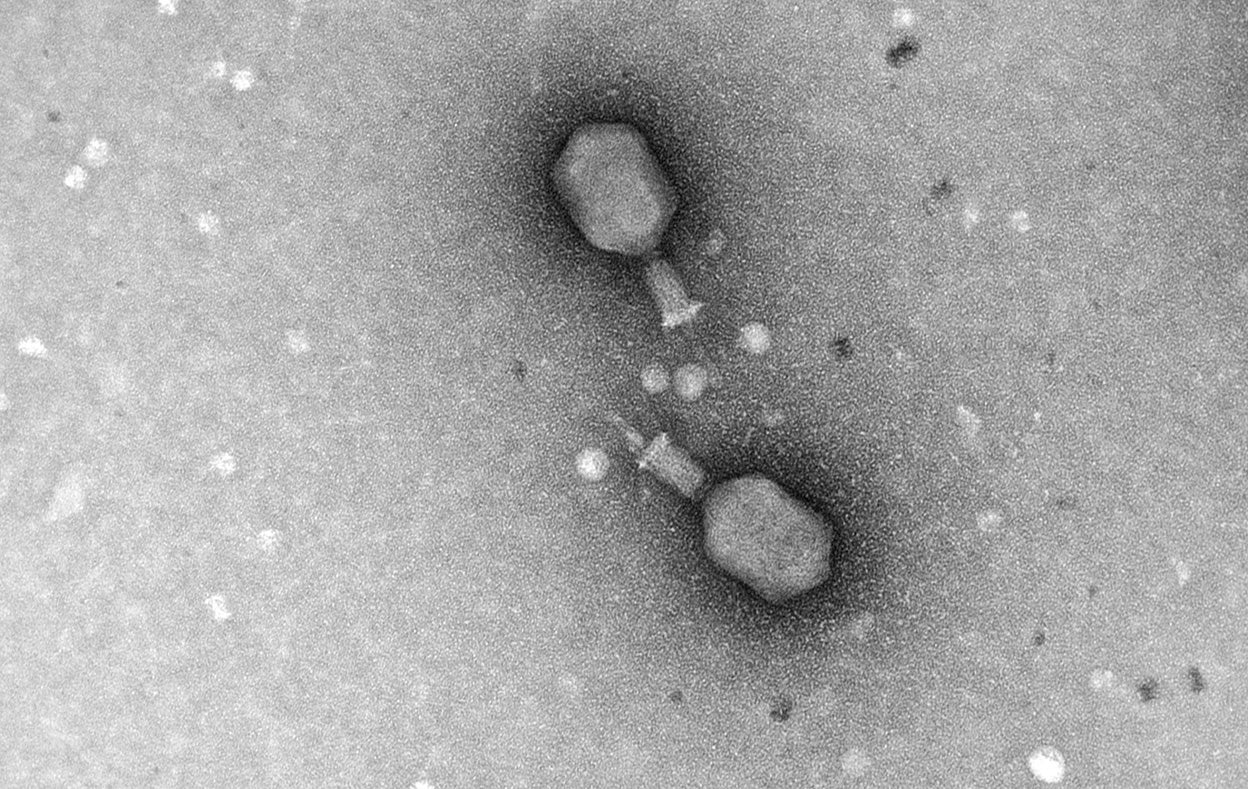 Viriones de fagos en el laboratorio de Pilar Domingo-Calap, en la Universidad de Valencia. Se aprecian la cabeza –contiene su ADN– y la cola. Con esta última detectan la bacteria, penetran con una enzima su carcasa protectora, la parte que menos posibilidades tiene de mutar, y se multiplican hasta hacerla estallar.