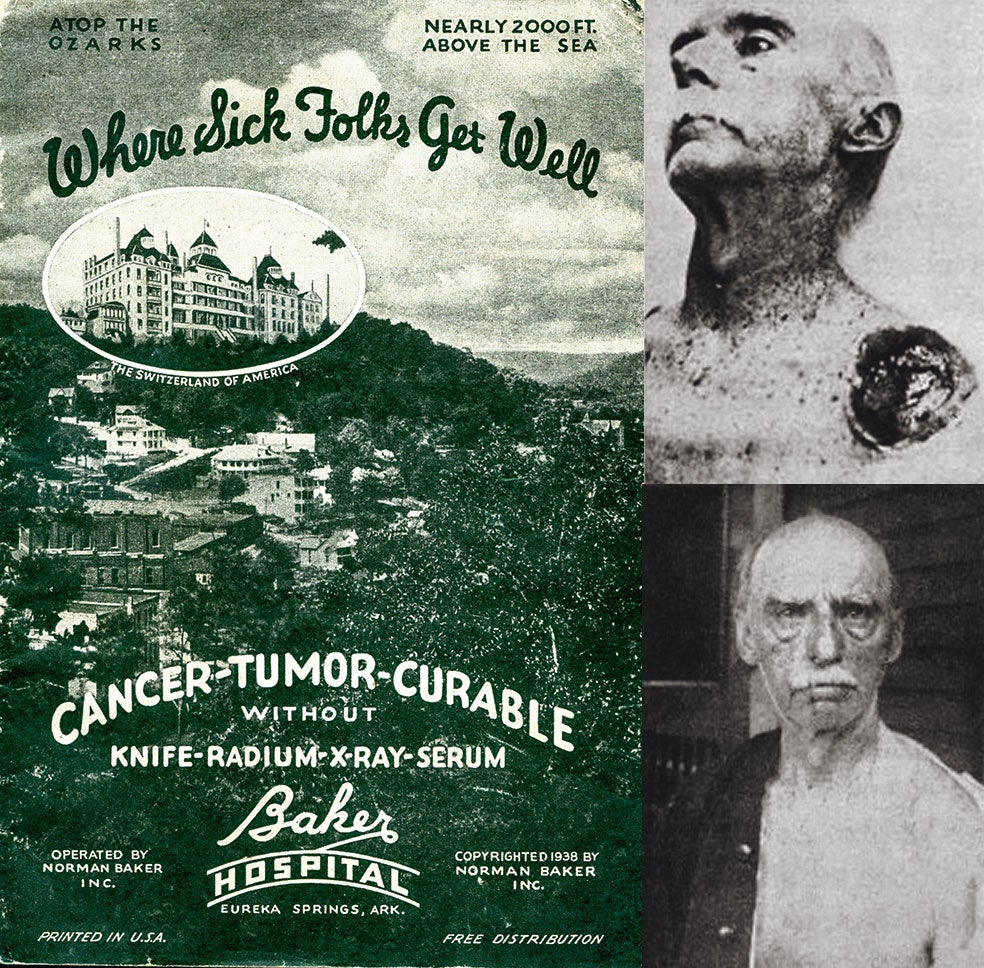 Los curanderos utilizaron la radio y la publicidad en prensa y propagaron sanaciones milagrosas como la de este expolicía de Chicago, 'curado' de un cáncer en el hombro.
