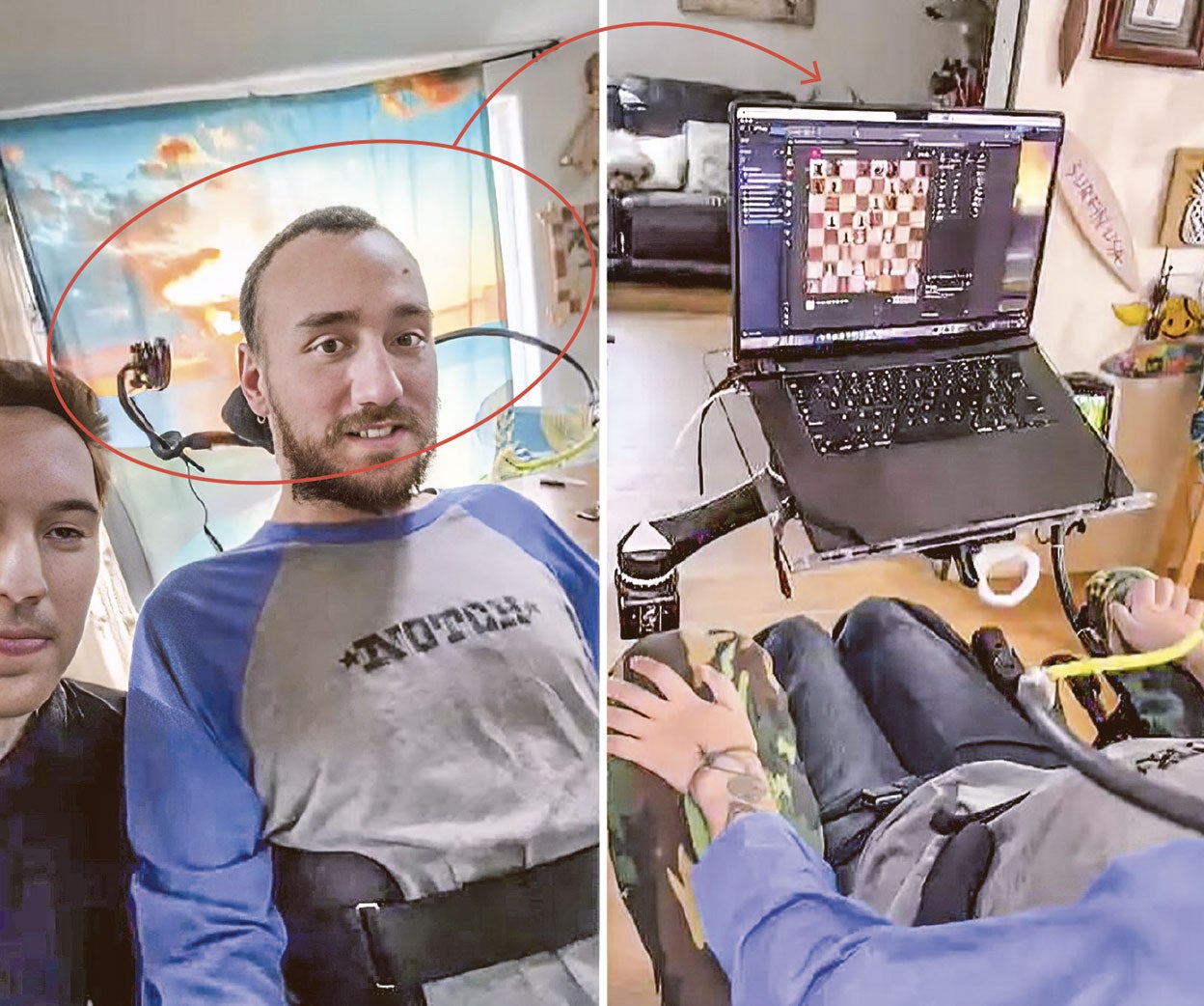 Noland Arbaugh –tetrapléjico desde 2016 tras un accidente de buceo– es el primer paciente de Neuralink, el dispositivo cerebral creado por la empresa de lon Musk. Le implantaron el chip en enero como ensayo de la interfaz cerebro-ordenador. Aunque es un estadio incipiente del proceso, asegura que ahora puede controlar el ordenador con la mente.