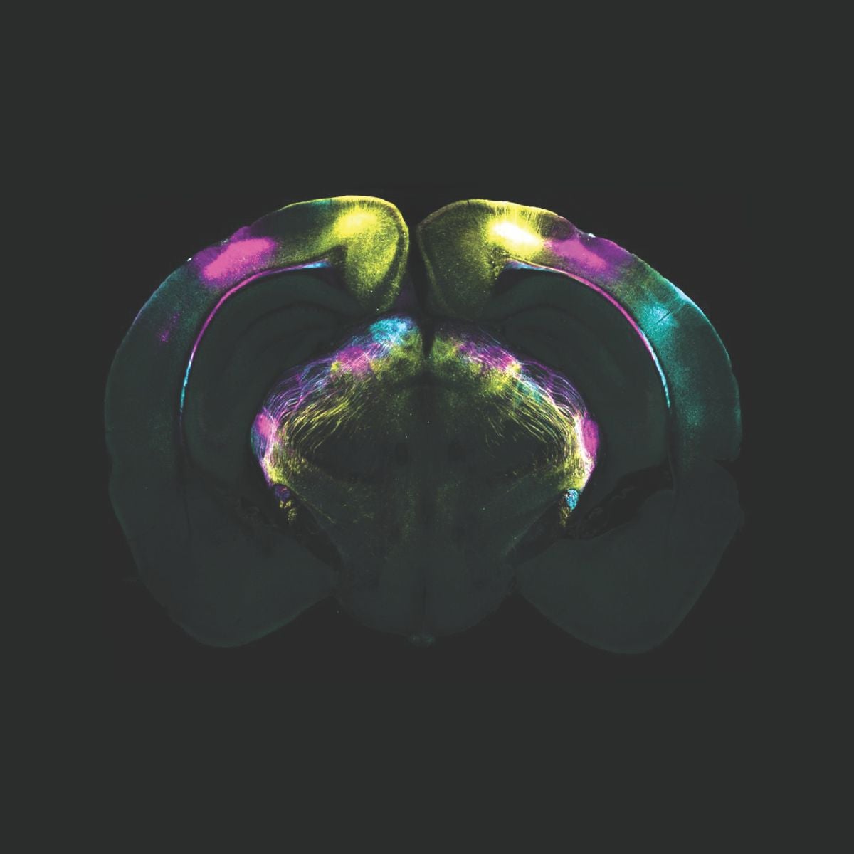 Corte del cerebro de un ratón que muestra las áreas implicadas en la supresión de las respuestas instintivas al miedo. La imagen, tomada en el Sainsbury Wellcome Centre de Londres, se ha logrado capturar gracias a la optogenética, una combinación de métodos genéticos y ópticos que permite controlar eventos específicos en ciertas células de tejidos vivos.